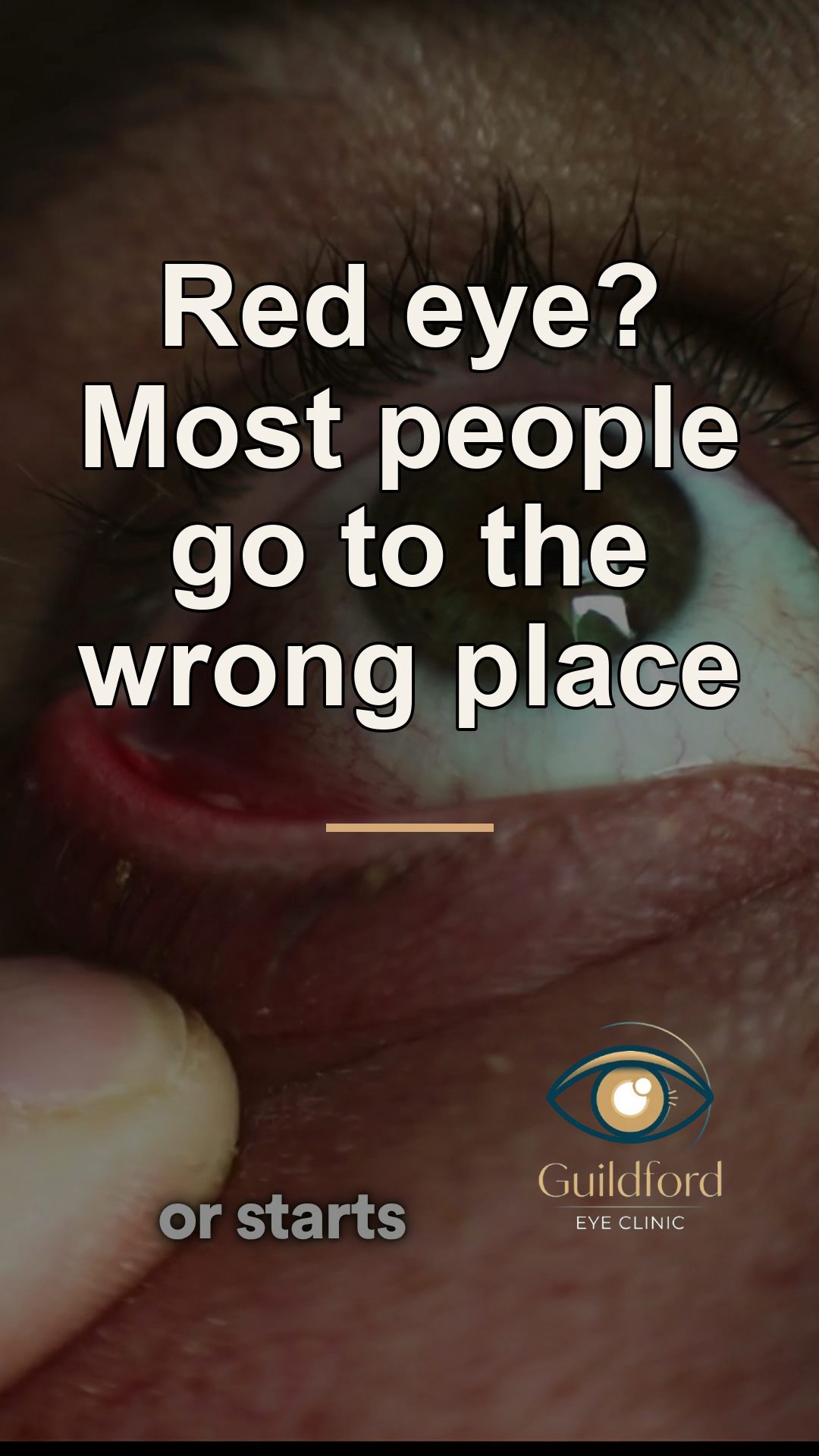 Where to go in an eye emergency