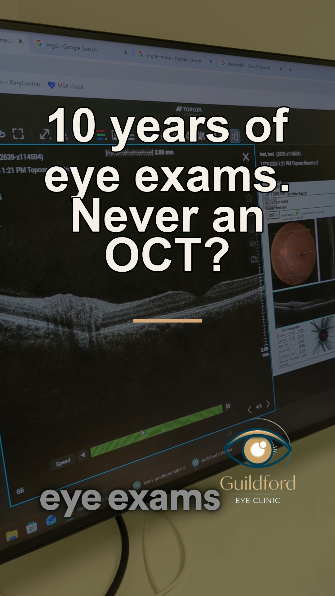 What an OCT scan shows